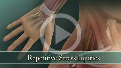 Repetitive Stress Injuries